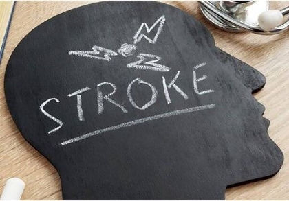 First Aid Management and Stroke Signs and Symptoms learn how to assist at a First Aid courses in Ipswich, dispel the myths about stroke