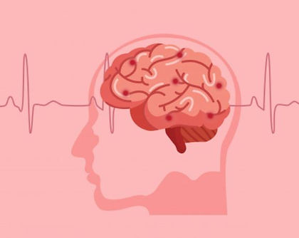 Stroke Management awareness, learn how to assist someone by doing a First Aid courses in Ipswich