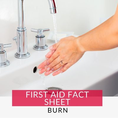 Person running hands underwater to help soothe a burn. learn burn first aid