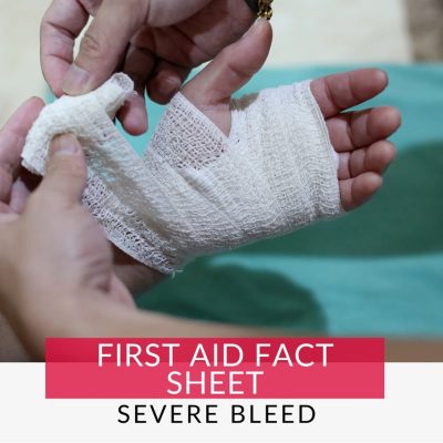 hand being wrapped in bandage to manage severe bleeding. Learn Severe Bleeding First Aid
